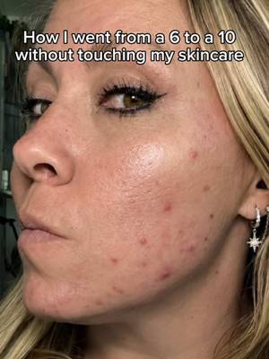 HUM Skin support dietary supplement