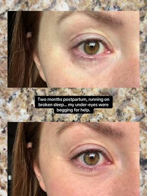 GoPure Instant Lift Eye Gel